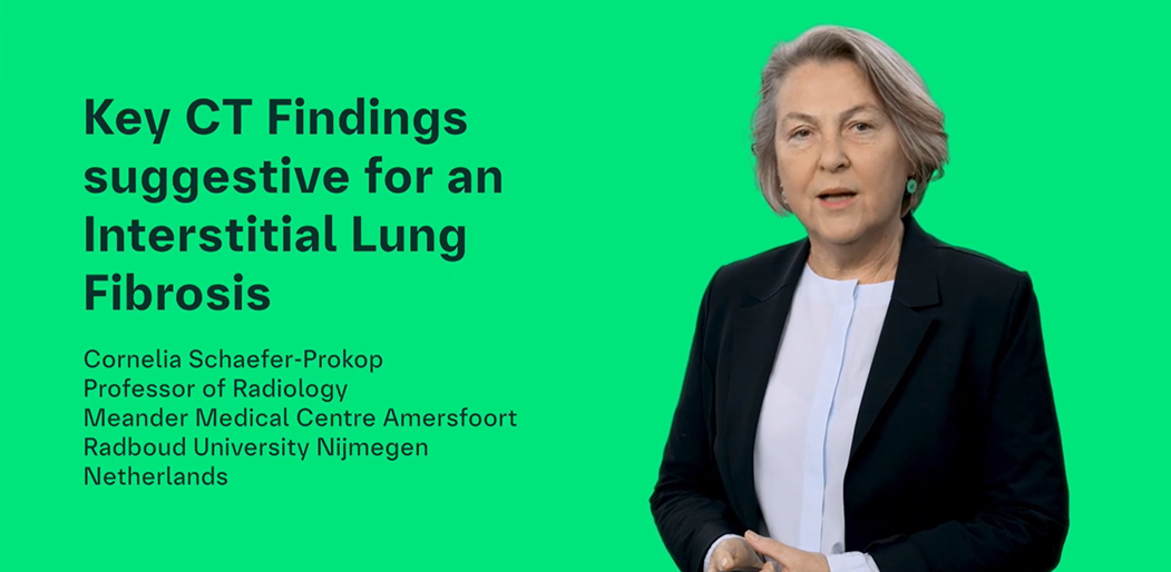 Key CT findings suggestive for an Interstitial Lung Fibrosis - Cornelia Schaefer-Prokop