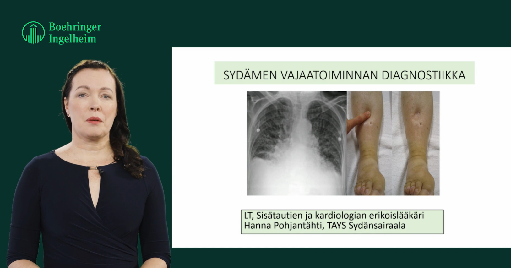 Sydamen vajaatoiminnan diagnostiikka